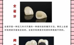 种牙与全瓷牙有何区别？哪种更适合你？