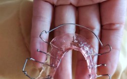 矫正牙齿后，保持器到底要戴多久？