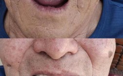 在辽宁省丹东市种牙，大家最关心哪些问题？比如价格多少、哪家医院靠谱、医保怎么报销、种植牙能用多久？