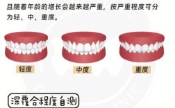 成人深覆合矫正方法有哪些？不同矫正方式（如传统托槽、隐形矫正、正畸正颌联合）的效果、周期及适应症该如何科学选择？