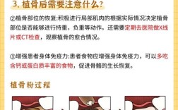 20年前种牙是否都需要植骨？当时技术条件如何？