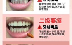 种牙后牙龈萎缩为何会发生？这些原因你需要了解吗？