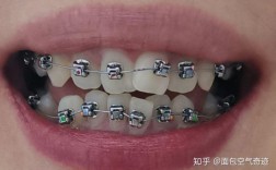 光华口腔矫正牙齿效果怎么样？好不好做？价格贵不贵？