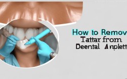 种植牙如何去牙石