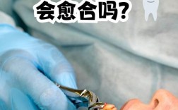 拔掉智齿后，是否都需要种牙来修复？