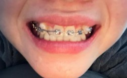 海淀妇幼保健院正畸