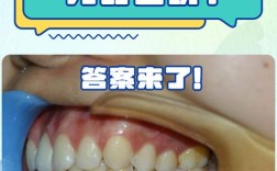 牙齿矫正反弹了？为何会反弹，如何有效处理？