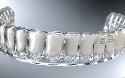 2025隐形矫正1年能矫好歪牙吗？