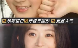 明星矫正牙齿图片为何频引关注？矫正效果有何不同？