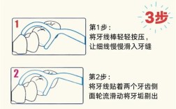 正畸治疗中调整中线位置的有效方法有哪些？