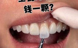 种一牙六千韩国烤瓷牙，价格合理质量有保障吗？