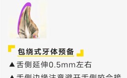 牙齿贴面预备方法的选择需考虑哪些因素？不同牙体条件下如何优化预备步骤以兼顾美观与牙体健康？