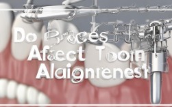 现在矫正牙齿，磨牙会影响效果吗？