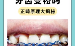 矫正过程中牙齿松动，是正常现象还是异常信号？