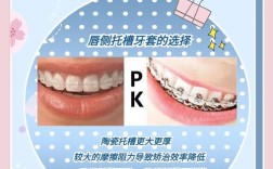 正畸托槽介绍ppt