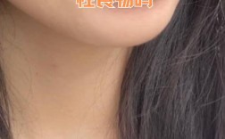 矫正牙齿期间，到底能不能正常吃东西？