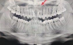 牙CT真的只有一种吗？不同口腔检查需求下，到底有哪些类型的牙CT，它们又有什么技术差异？