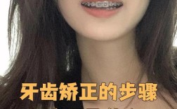 50岁牙齿矫正可行吗？有哪些适合的方法？