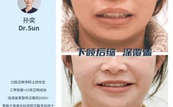 牙齿矫正会影响下巴形态吗？