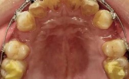 梅志强正畸视频讲什么？正畸效果靠谱吗？