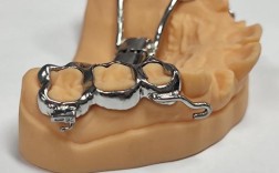 牙齿矫正扩弓是什么？扩弓矫正的原理与作用？