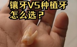 拔牙很久了还能种牙吗