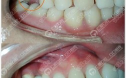 武汉种牙承喏仁爱f