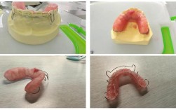 牙合垫主要分为哪两种类型？它们各自的设计原理、适用症状及临床应用场景有何不同？