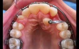 北京牙齿矫正哪里便宜又靠谱？