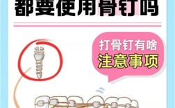 正畸牙为什么打骨钉