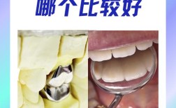 戴假牙和种牙到底哪个更适合？舒适度、使用寿命、费用大比拼，不同人群该如何抉择？