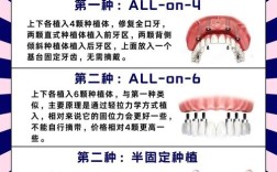 种牙的方式有哪些