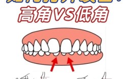 kq88正畸打开咬合的方法有哪些？