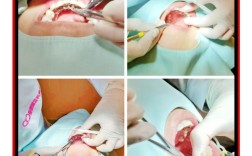 香港矫正牙齿，为何吸引内地人？需注意啥？