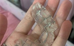 牙齿正畸颌垫是什么？矫正中起什么作用？