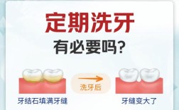 种牙期间能洗牙吗？医生提醒这几点要注意