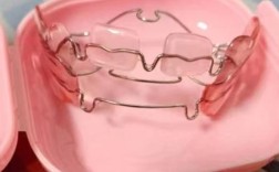 口腔正畸肌功能矫治器