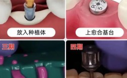 种牙需要检查什么