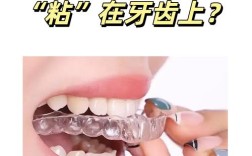 牙齿粘托槽矫正方法如何操作？详细步骤和注意事项有哪些？