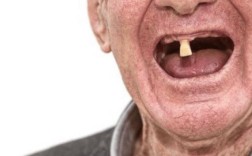 老人植牙会掉吗