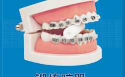 正畸科什么叫隐适美