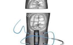 口腔常见缝合方法有哪些类型及适用场景？