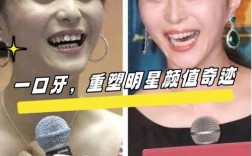 明星晒矫正牙齿照，有何深层用意？
