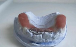 正畸双曲舌簧弯制方法的核心要点是什么？