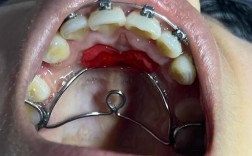 成都牙科矫正牙齿，效果好不好价格贵不贵怎么选？