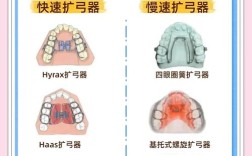 带牙齿矫正器注意事项