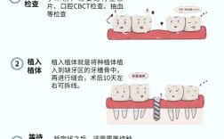 美国种牙过程图片具体包含哪些详细步骤和关键细节？