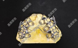 数字化正畸设计