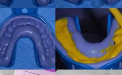 正畸硅橡胶取模方法