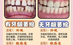 正畸期间如何有效预防牙龈萎缩？